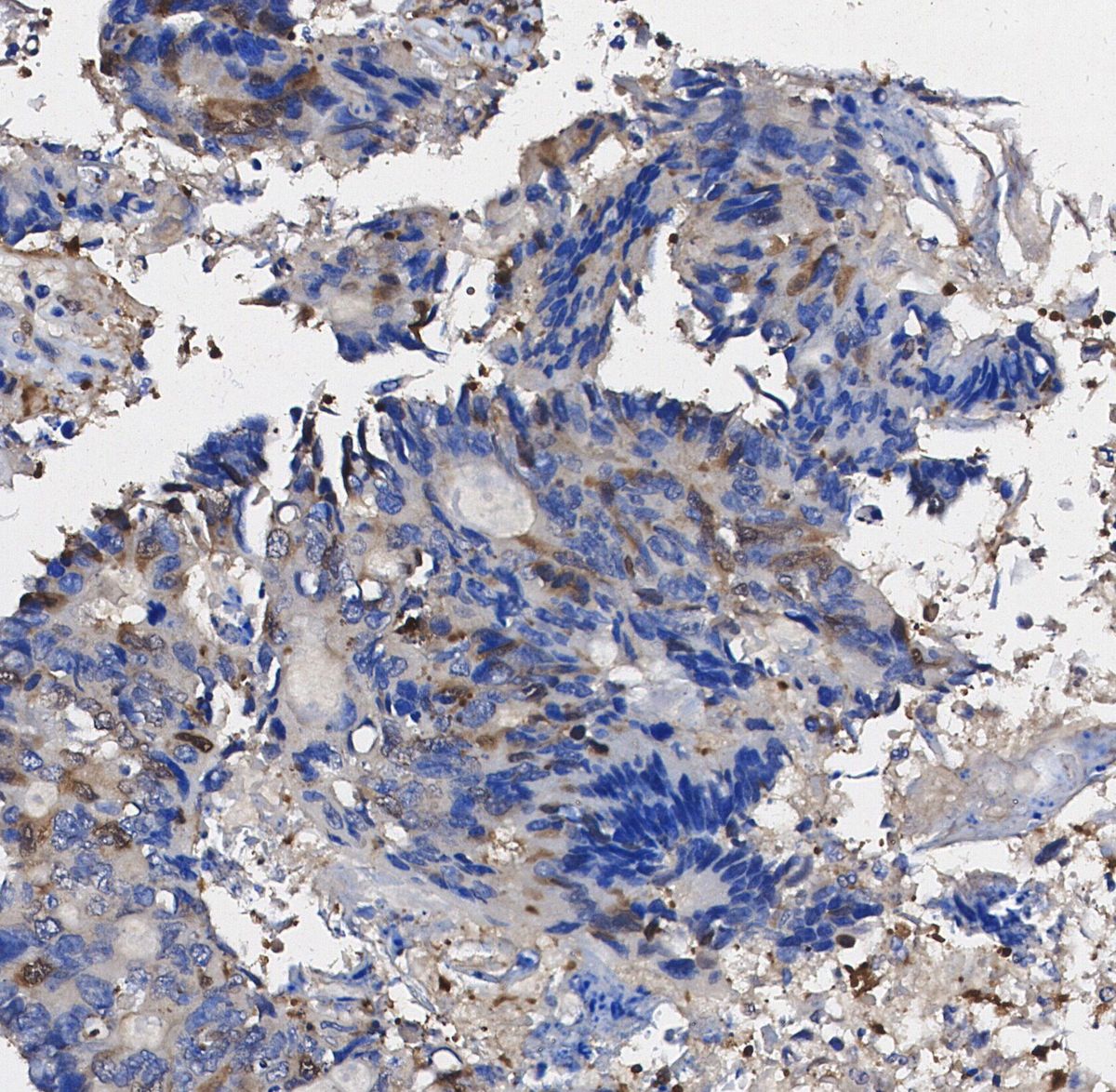 MMP9 Antibody
