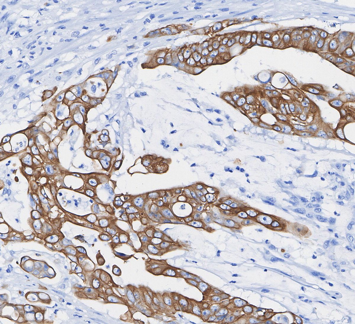 β-Actin Antibody