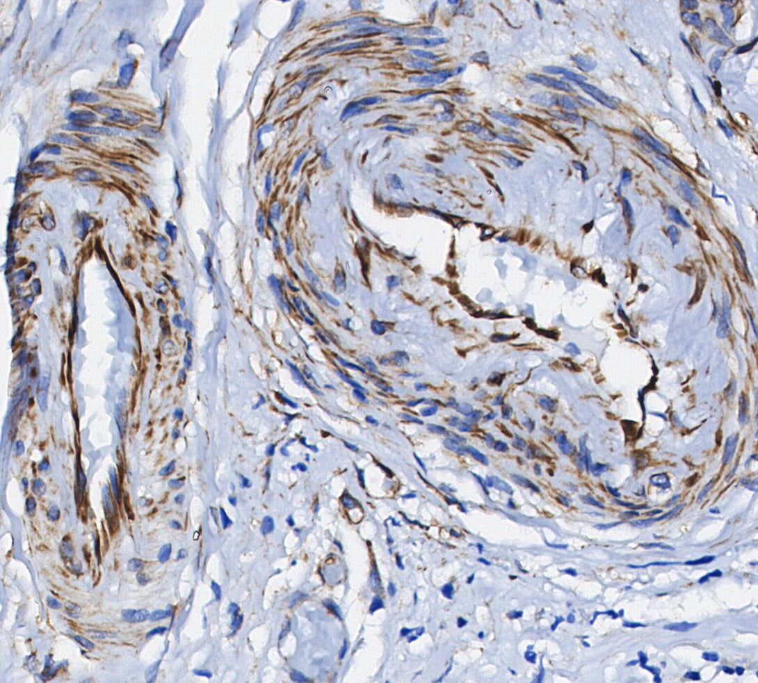 α-Smooth Muscle Actin Antibody