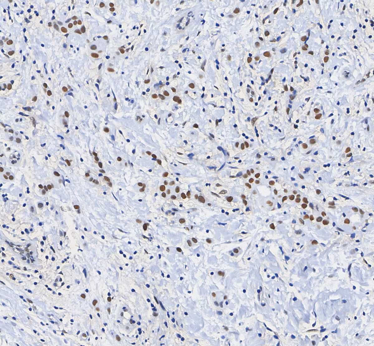 Histone H3 (di methyl Lys9) Antibody