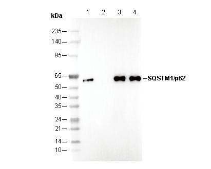 SQSTM1 / p62 Antibody