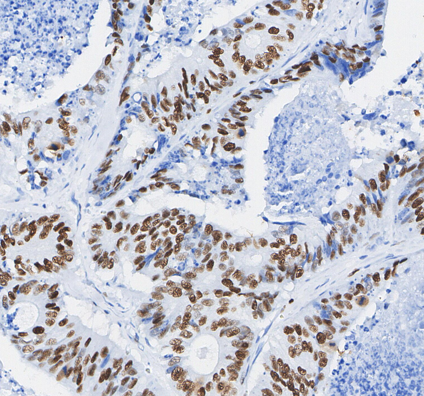 Cleaved PARP (Asp214) Antibody
