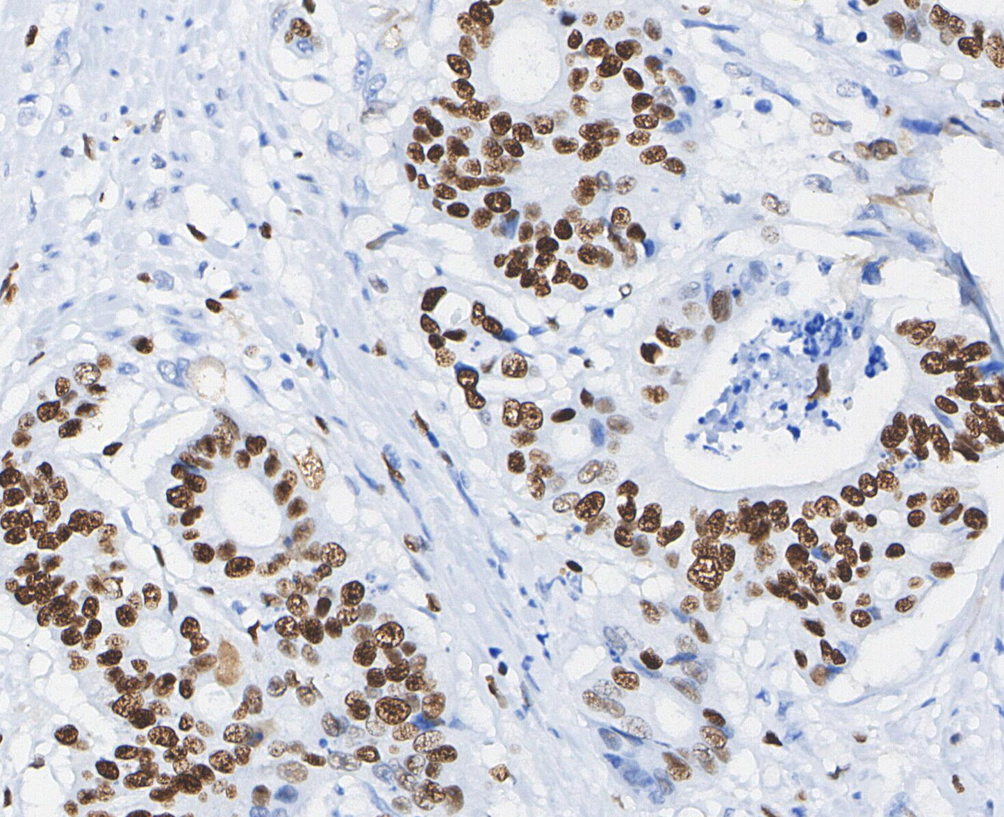 Cyclin D1 Antibody