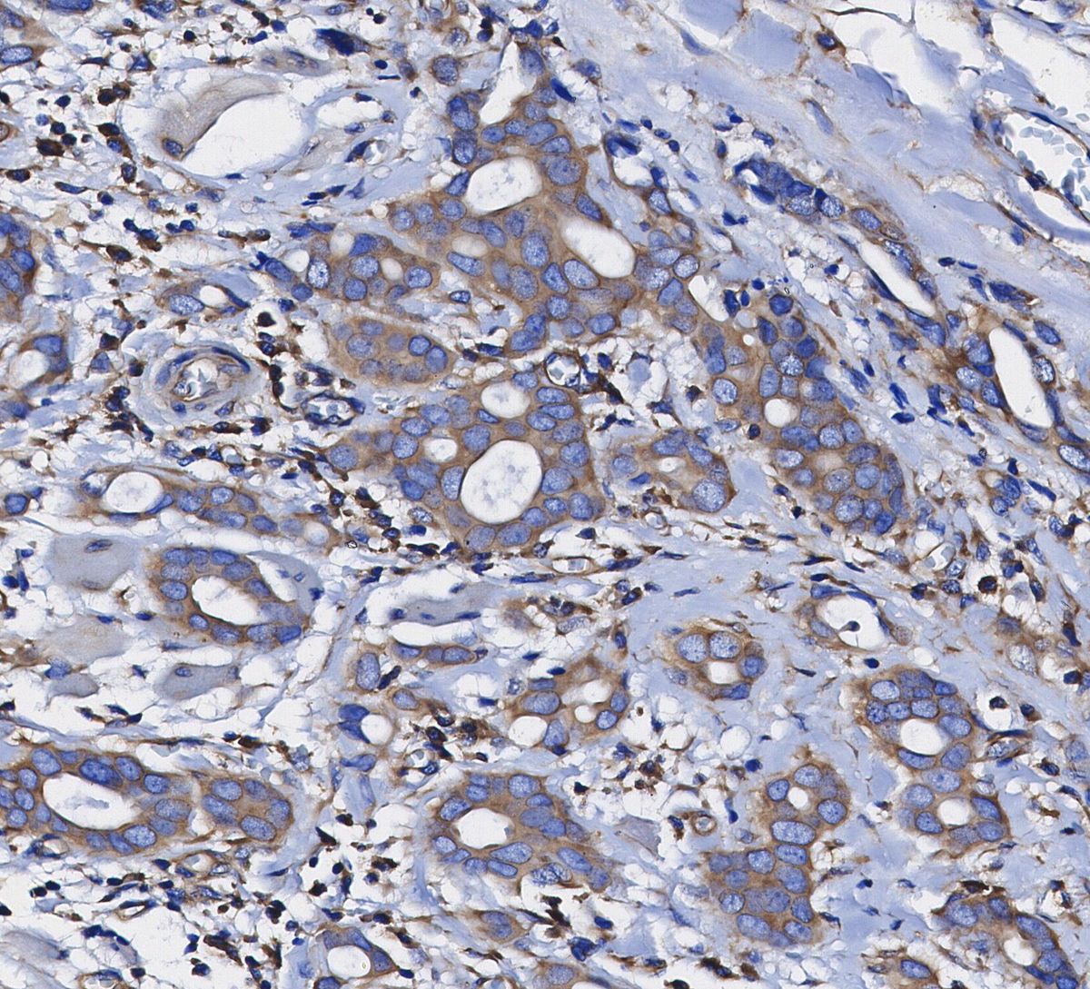 S6 Ribosomal Protein Antibody