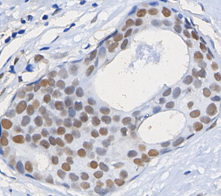 Histone H3 (tri methyl Lys27) Antibody