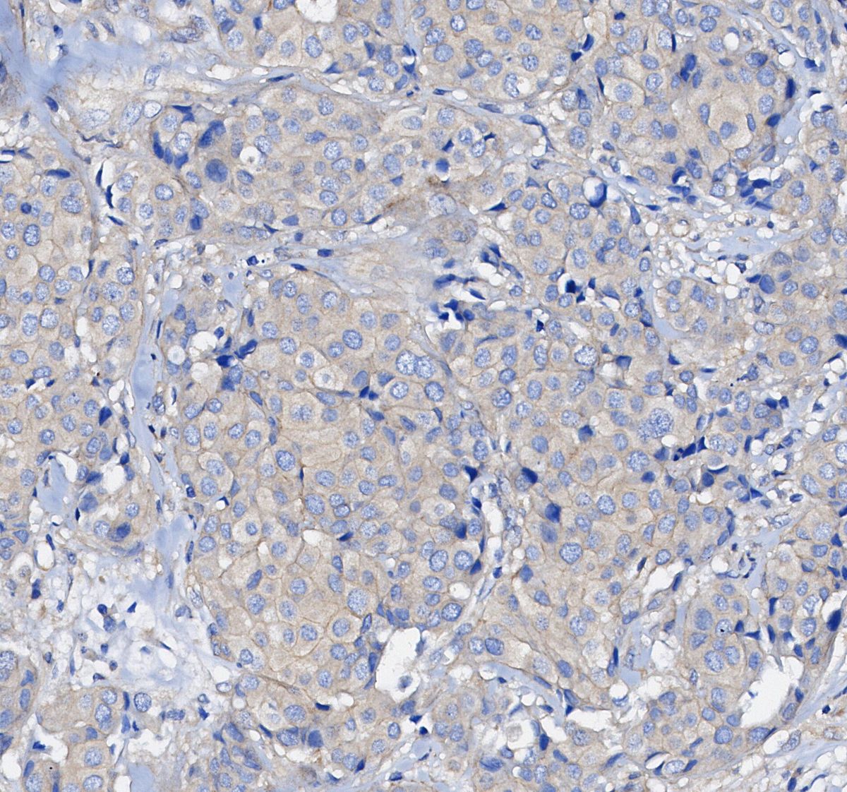 mTOR Antibody