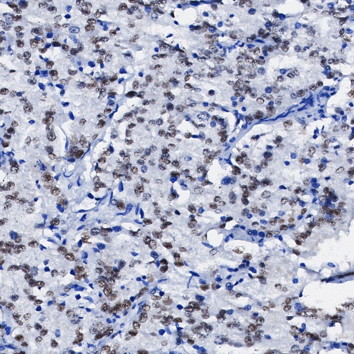 Androgen Receptor Antibody