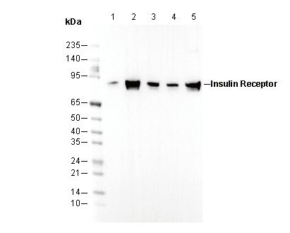 Insulin Receptor β Antibody