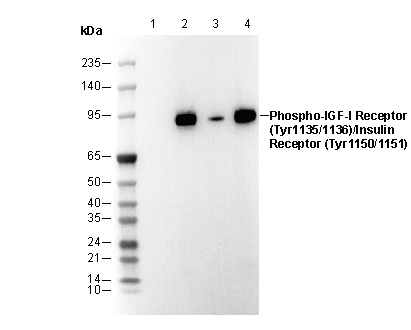Phospho-IGF-1R (Y1135/1136)/IR (Y1150/1151) Antibody