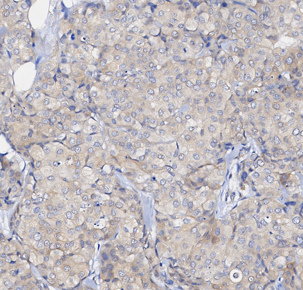 Stat1 Antibody