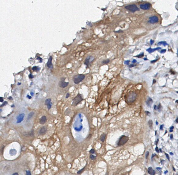 COX2 / Cyclooxygenase 2 Antibody