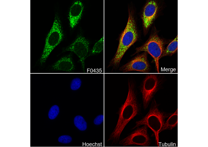 Hexokinase 1 Antibody