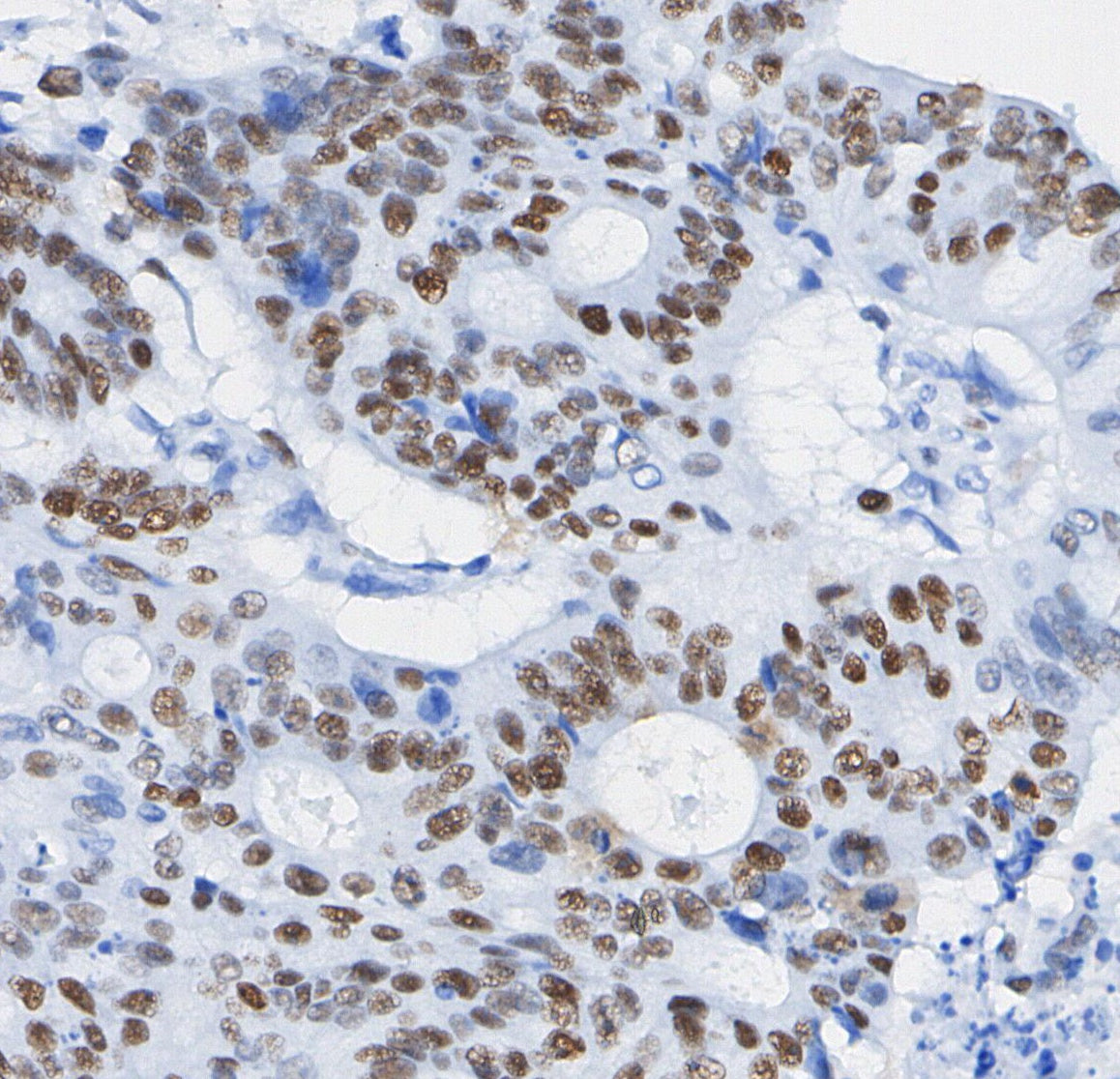 TCF1/TCF7 Antibody