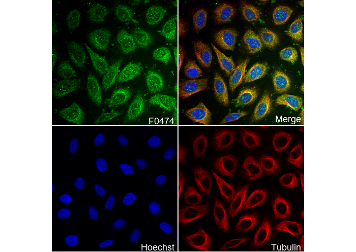Cathepsin B Antibody