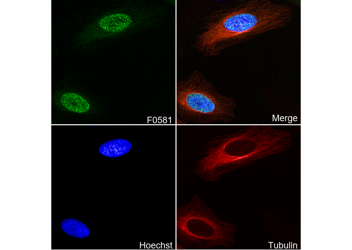 MCM2 Antibody