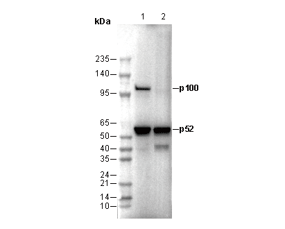 NF-κB2 p100/p52 Antibody