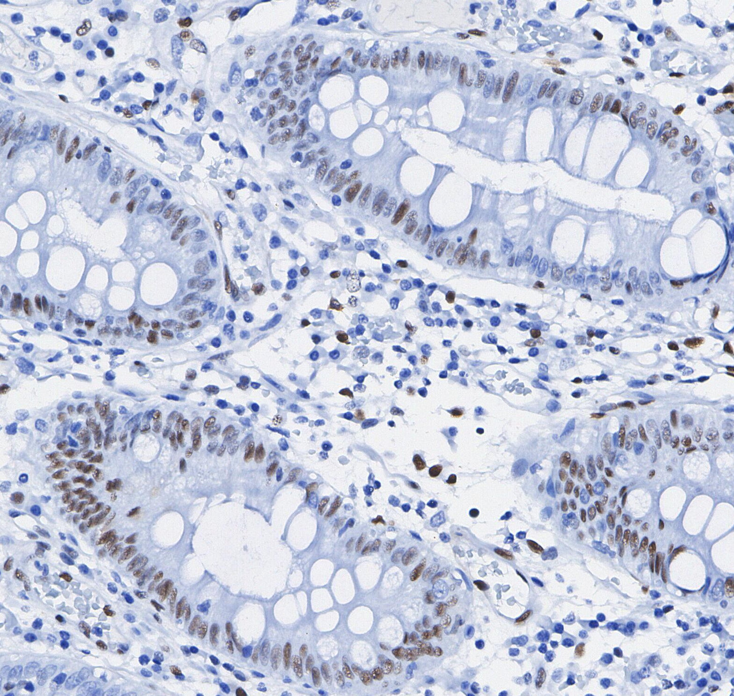 HAUSP Antibody