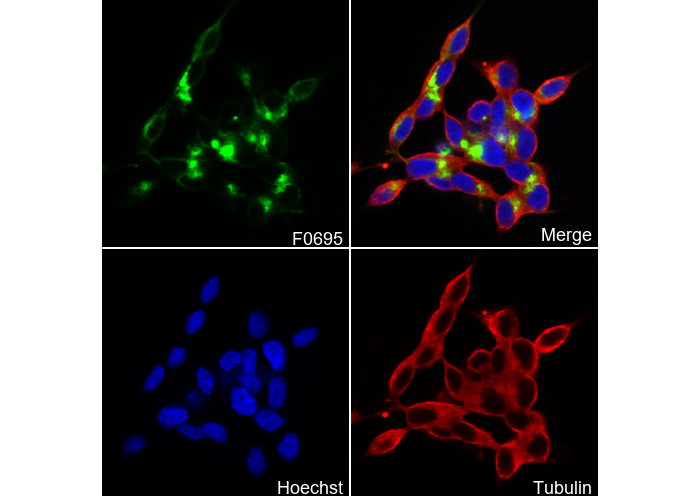 Neurofilament-M Antibody