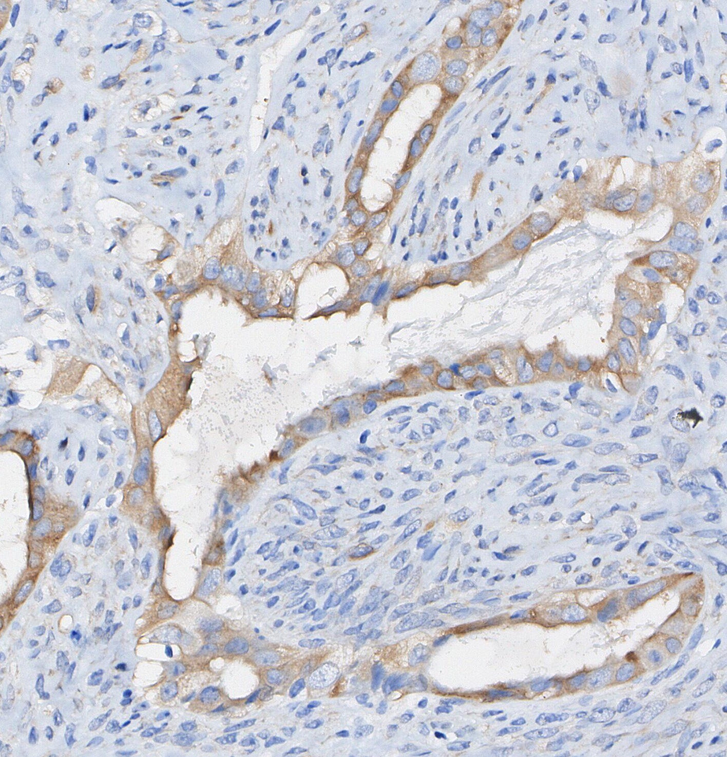 Phospho-PLCγ1 (Ser1248) Antibody