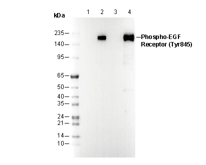 Phospho-EGF Receptor (Tyr845) Antibody