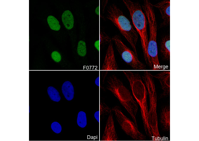 ASF1A Antibody