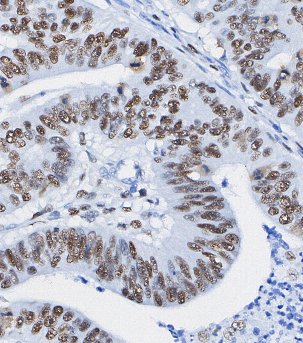 Progesterone Receptor B Antibody