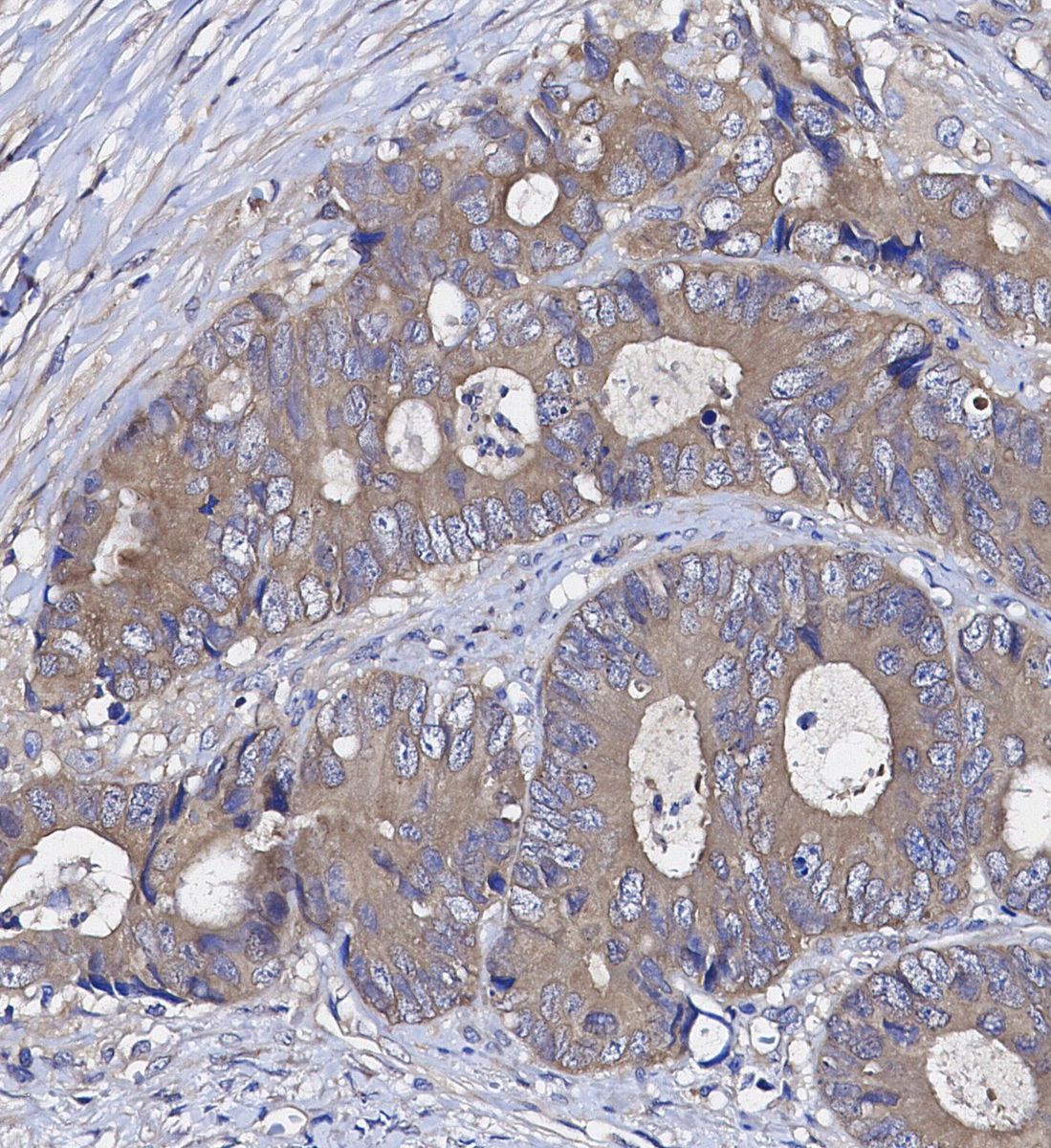 Smac/Diablo Antibody