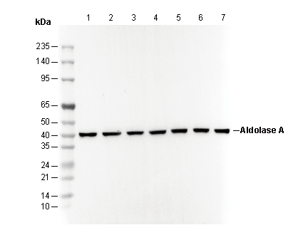 Aldolase A Antibody