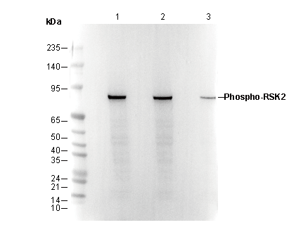 Phospho-RSK2 (Ser227) Antibody