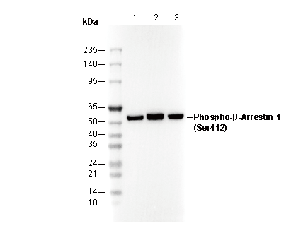 Phospho-β-Arrestin 1 (Ser412) Antibody