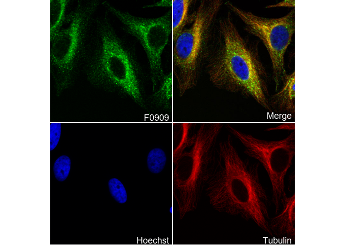 RRM1 Antibody