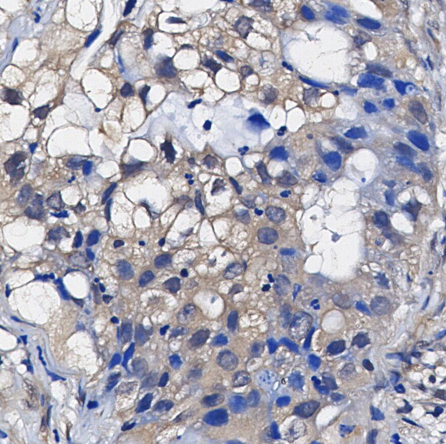 Radixin Antibody