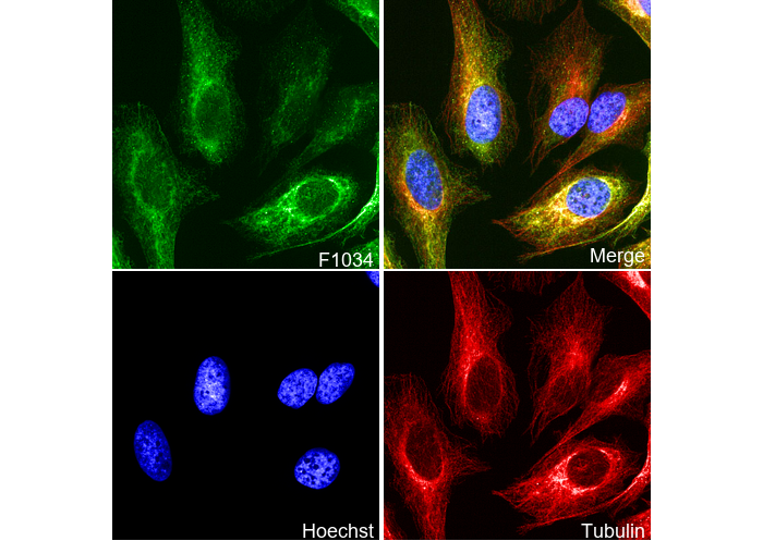 Cytokeratin 18 Antibody