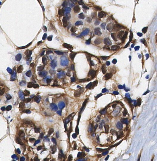 RBX1 Antibody