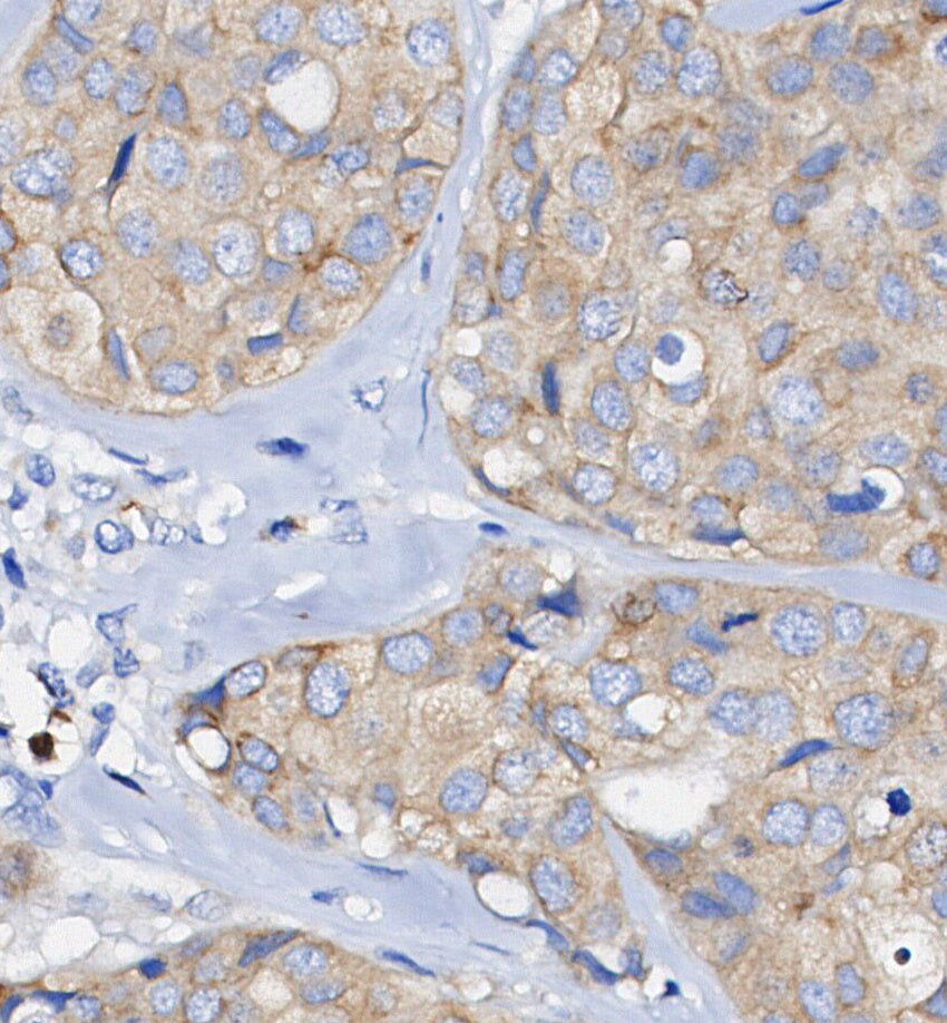 AMPK β1 Antibody