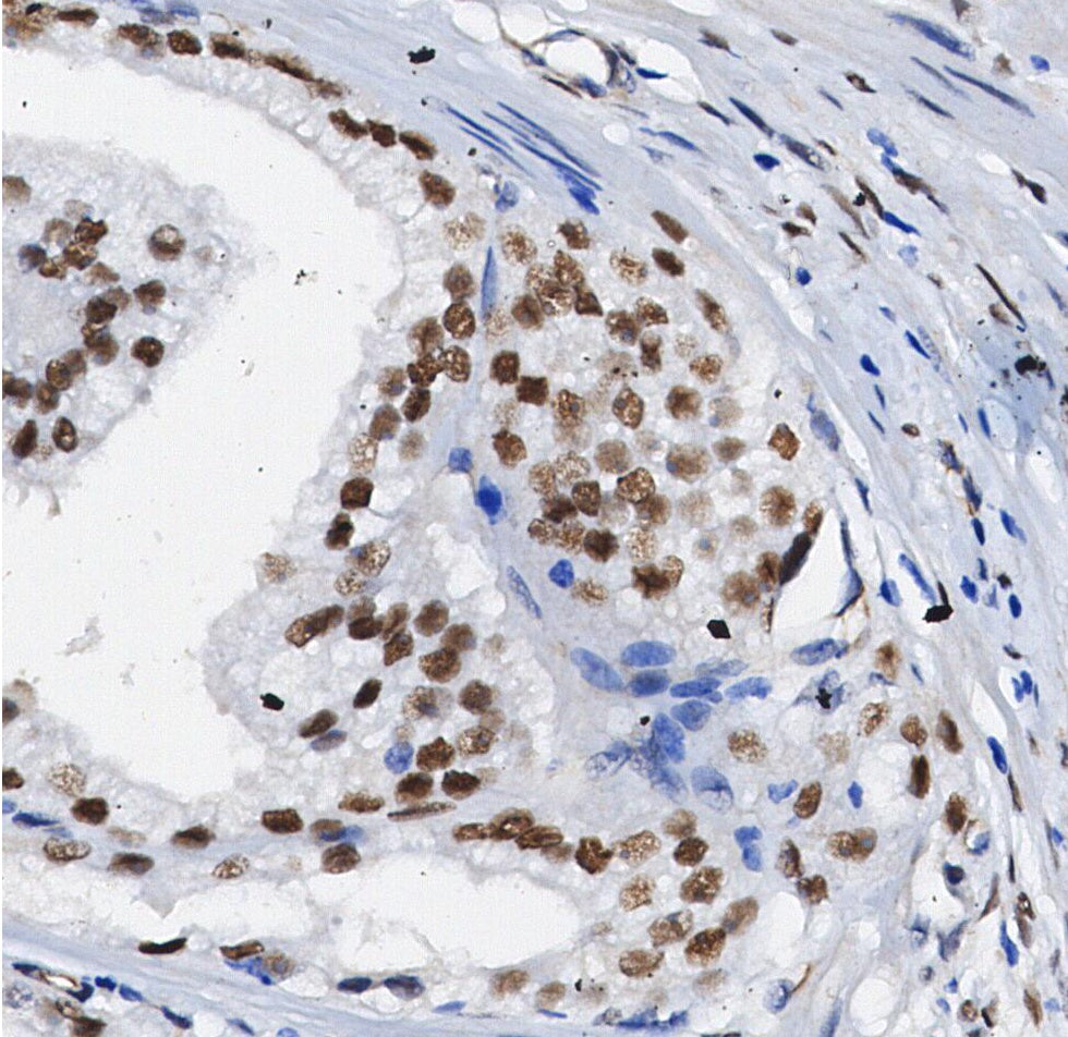 Brd4 Antibody