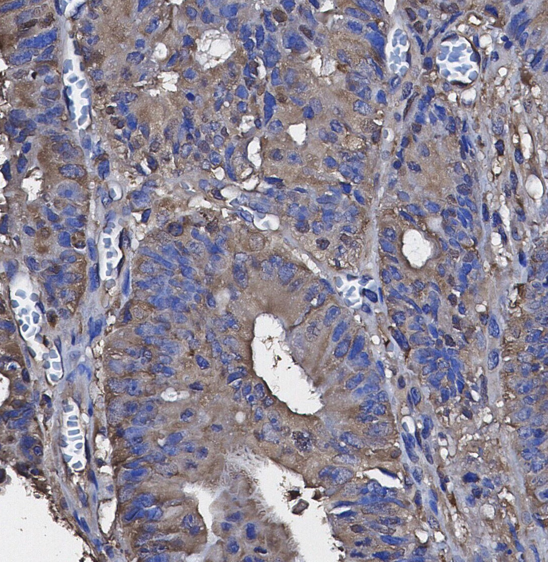 CBS Antibody