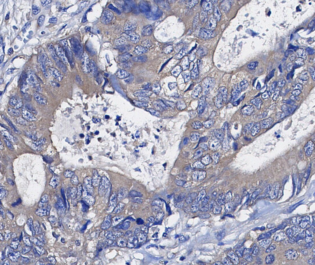 Hsp90 β Antibody
