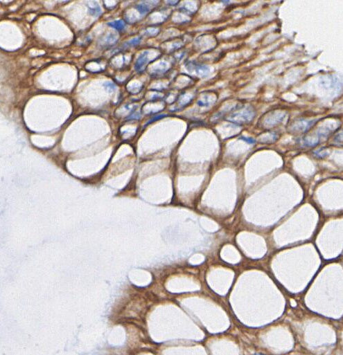 VCAM1 Antibody