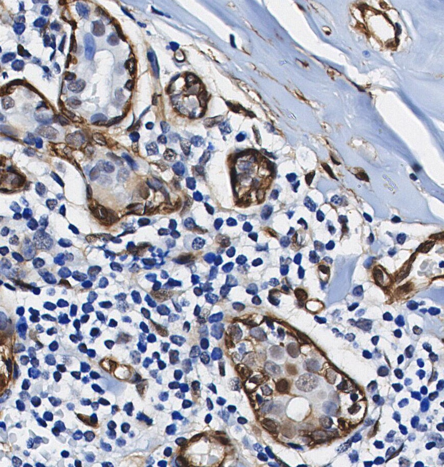 β Arrestin 1 Antibody