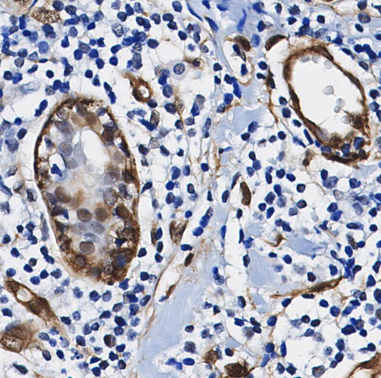 ATP citrate lyase Antibody