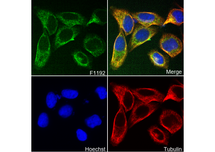 Glucose Transporter GLUT1 Antibody