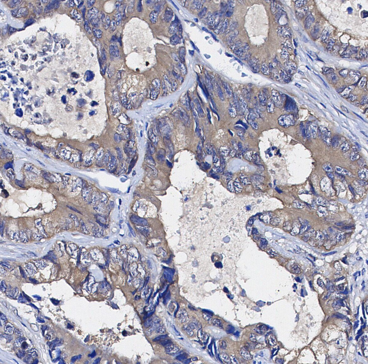 MUC1 Antibody