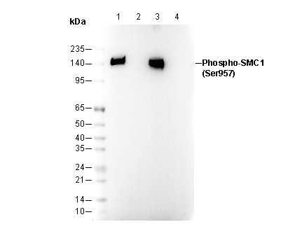 Phospho-SMC1 (Ser957) Antibody