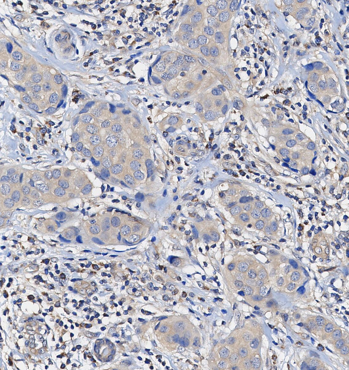 eIF3H Antibody