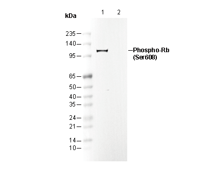 Phospho-Rb (Ser608) Antibody