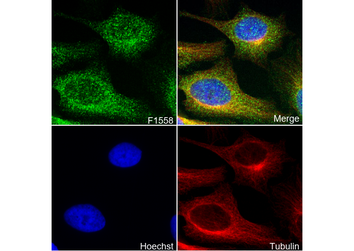 ROCK2 + ROCK1 Antibody