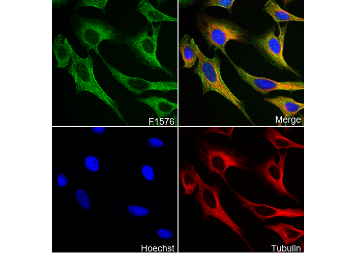 Cardiac Troponin T Antibody