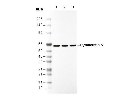 Cytokeratin 5 Antibody