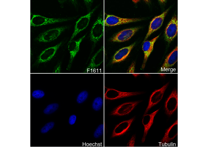 ATPB Antibody